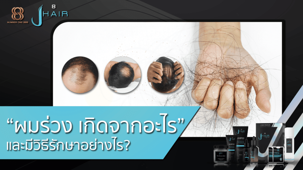 "ผมร่วง" เกิดจากอะไร และมีวิธีรักษาอย่างไรบ้าง? - สาระน่ารู้จาก Jhair