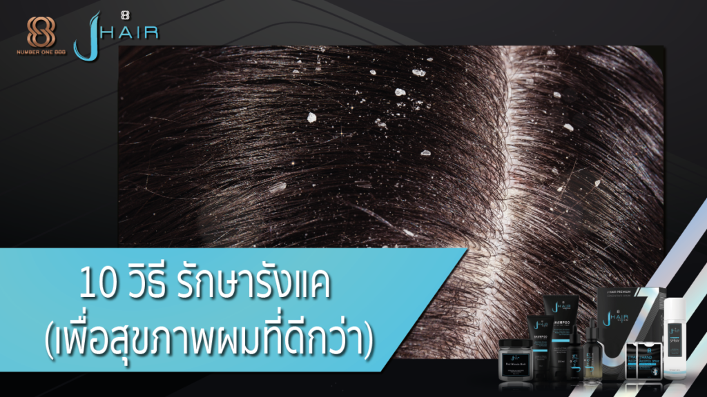 รักษารังแค - Jhair serum